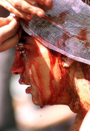 bloody1.jpg