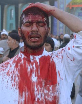bloody3.jpg