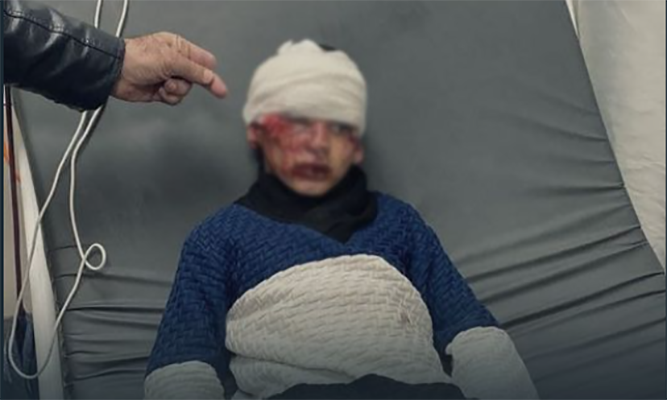 injured child