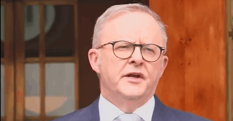 Anthony Albanese