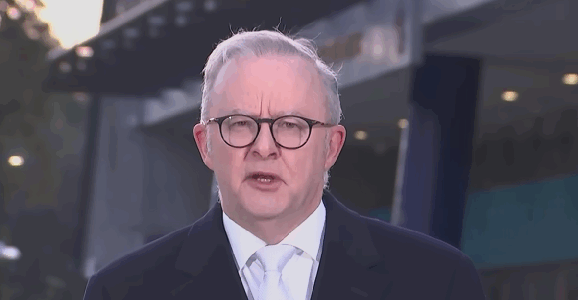 anthony albanese