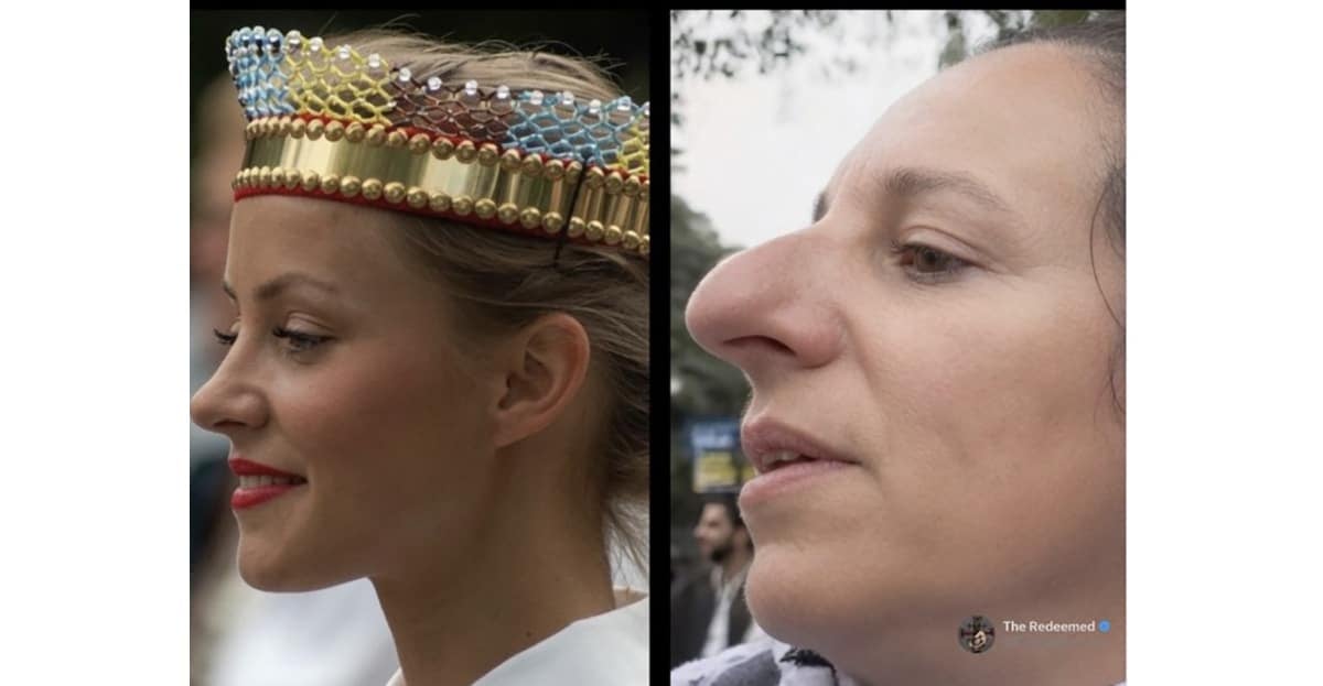 noses