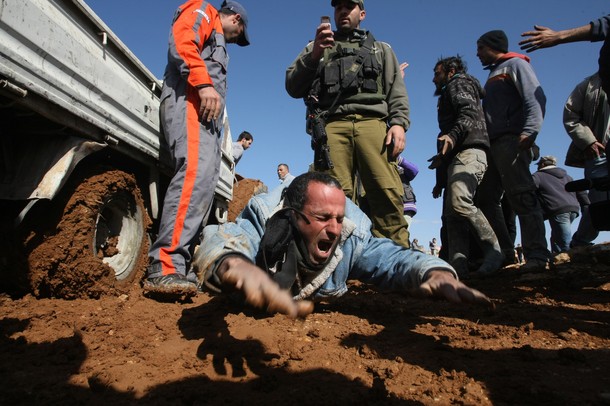 An injured Palestinian construction work