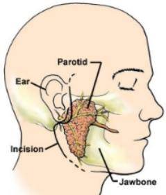 parotid