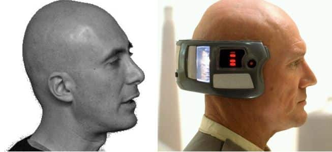 sheedy lobot